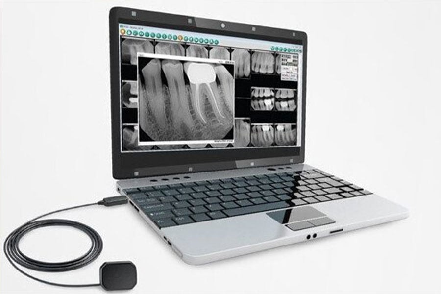 Our pain-free dental office in Orland Park, IL is proud to use advanced dental technology near Orland Park, IL to create an individualized treatment plan just for you! Digital Radiography in Orland Park, IL